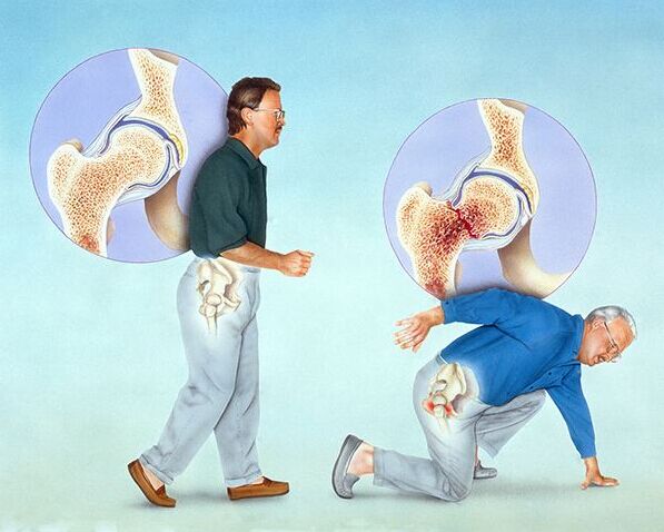 超声骨密度仪的测量方法有哪些？