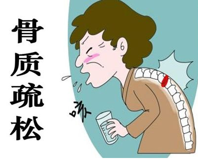超声骨密度仪厂家告诉您骨质疏松需要做的检查 超声骨密度仪厂家告诉您骨质疏松需要做的检查