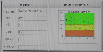 骨密度检测仪测量结果了解一下啦！