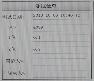 骨密度检测仪测量结果了解一下啦! 骨密度检测仪测量结果了解一下啦!
