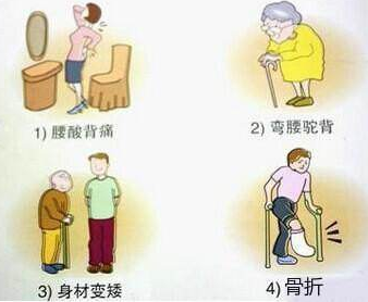 超声骨密度仪厂家提醒用了激素要查骨密度 超声骨密度仪厂家提醒用了激素要查骨密度