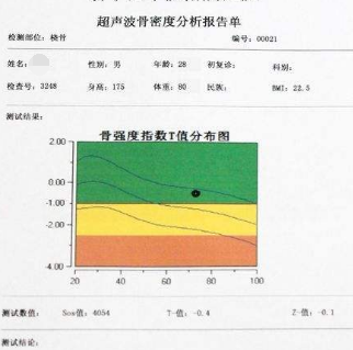 骨密度检测仪针对骨密度检测结果的分析 骨密度检测仪针对骨密度检测结果的分析