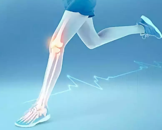 双12丨【超声骨密度仪】品牌国康奉告骨质疏松“偏爱”人群，用公式测出你的骨密度