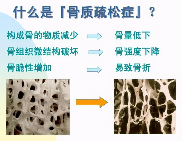 叮咚!山东国康开课喽!科普一下超声波骨密度检测仪测量方法