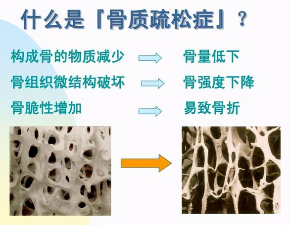 叮咚！山东国康开课喽！科普一下超声波骨密度检测仪测量方法